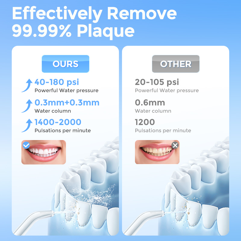 Sejoy Water Flosser Teeth Pick - огляд і ціна Water Flosser Cordless