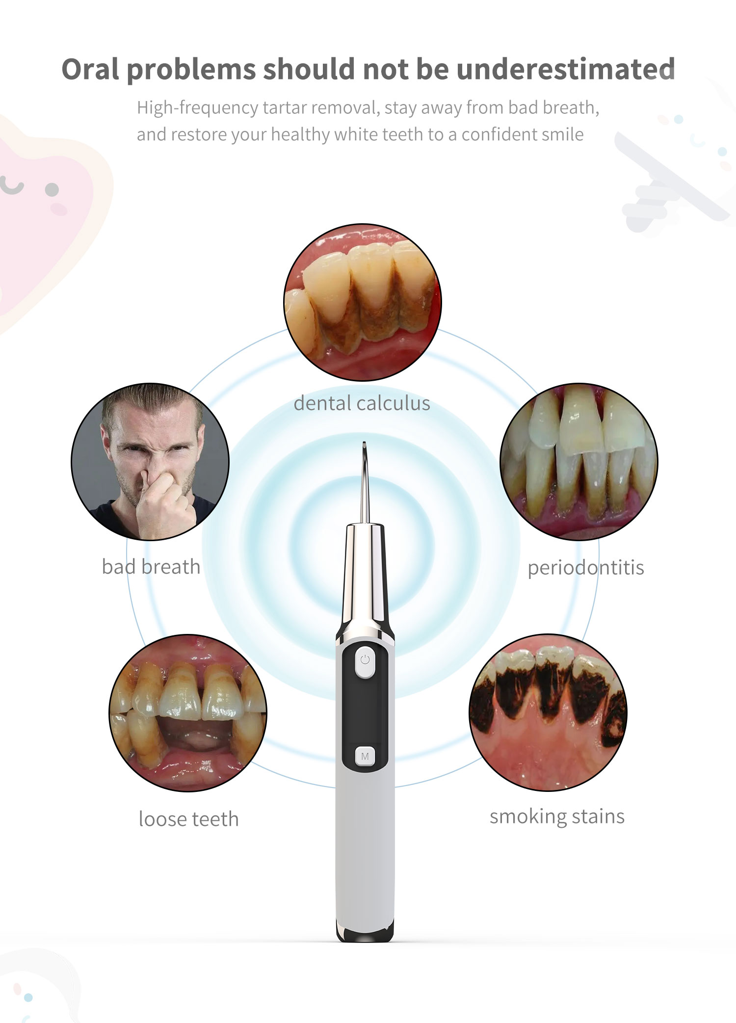 Electric Sonic Dental Calculus - огляд і ціна Teeth Whitening Or Tooth Whitening