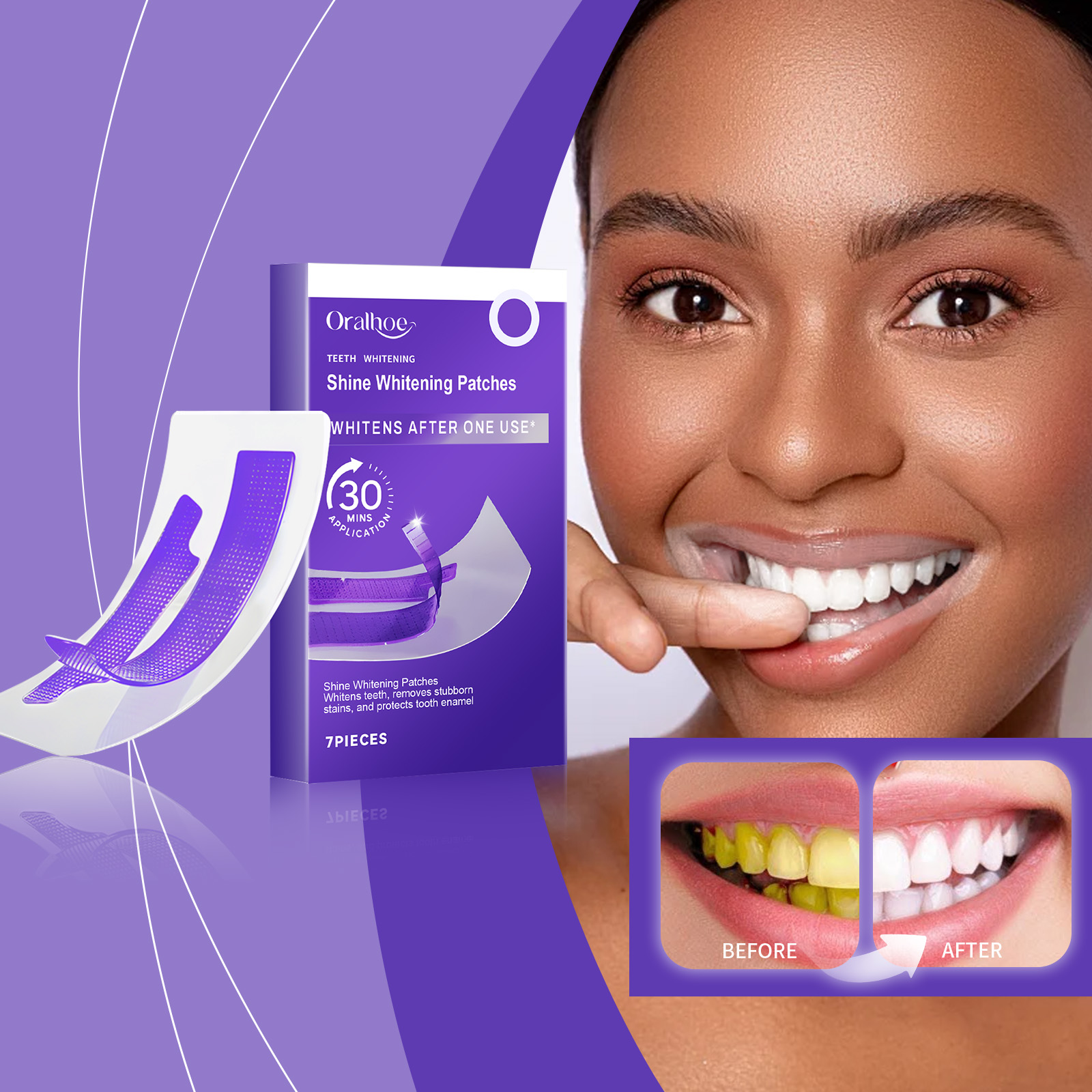 Purple Teeth Whitening Strips  - огляд і ціна Teeth Whitening/Bleaching