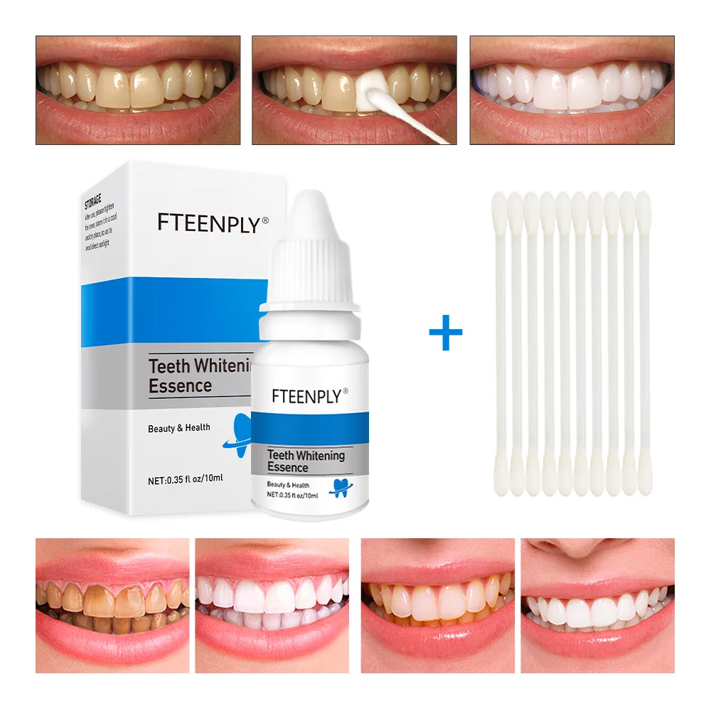 FTEENPLY Teeth Whitening Essen - огляд і ціна Teeth Whitening Groupon