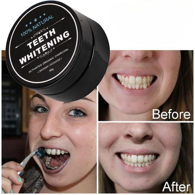 1 Box Activated Charcoal Teeth - огляд і ціна Teeth Whitening Groupon
