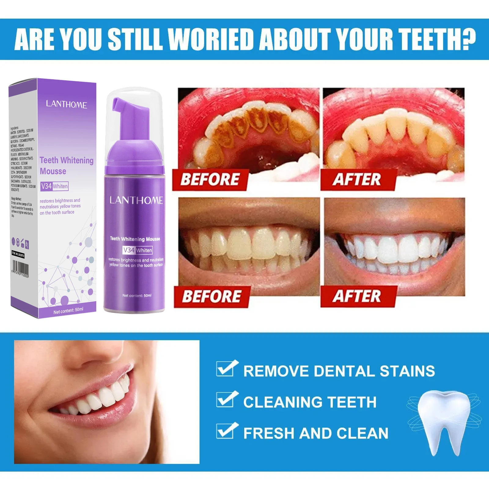 V34 Teeth Whitening Mousse Too - огляд і ціна Teeth Whitening Xylitol