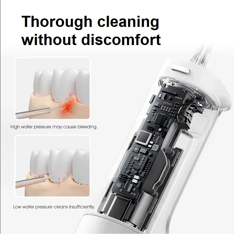 Xiaomi Mijia Oral Irrigator2 U - огляд і ціна Water Flosser Cordless