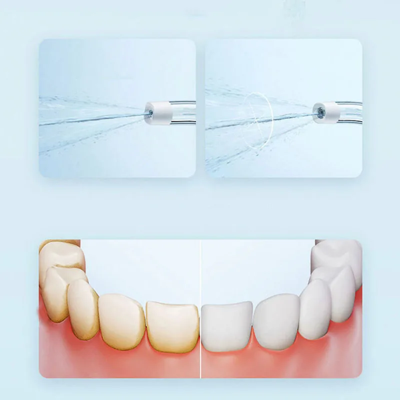 Xiaomi Portable Oral Irrigator - огляд і ціна Teeth Whitening Or Tooth Whitening