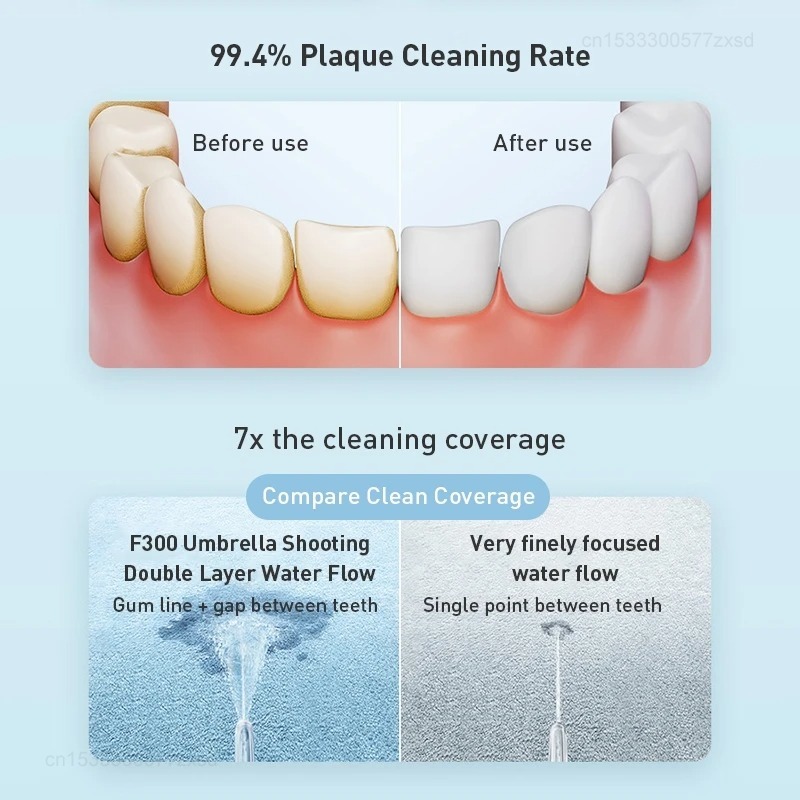 XIAOMI MIJIA Portable Oral Irr - огляд і ціна Water Flosser Cordless
