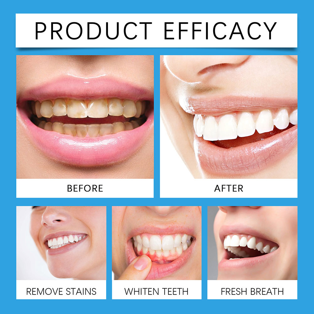 Professional Teeth Stain Remov - огляд і ціна Teeth Whitening For Photos